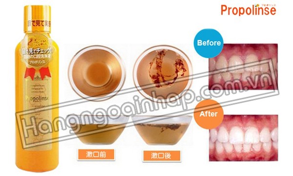 Nước Súc Miệng Diệt Khuẩn Và Làm Sạch Mảng Bám Propolinse Của Nhật