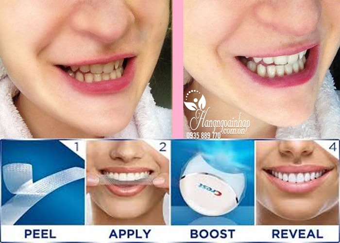 Máy làm trắng răng Crest 3D White No Slip Whitestrips