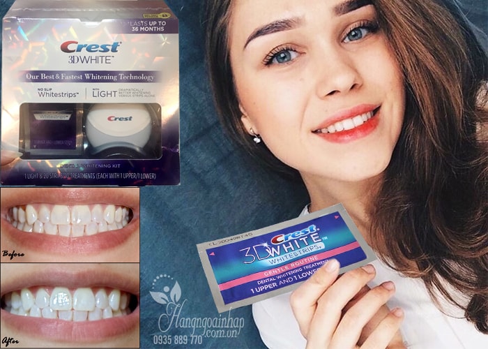 Bộ sản phẩm tẩy trắng răng hiệu quả Crest 3D White No Slip Whitestrips With Light