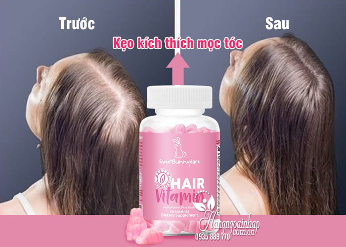 Kẹo dẻo kích thích mọc tóc Sweet Bunny Vegan Hair Vitamin 2