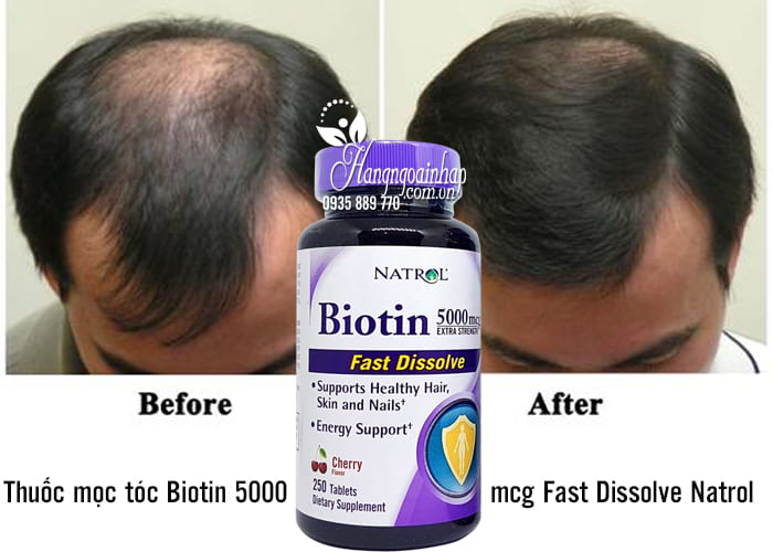 Thuốc mọc tóc Biotin 5000mcg Fast Dissolve Natrol của Mỹ 250 viên 2