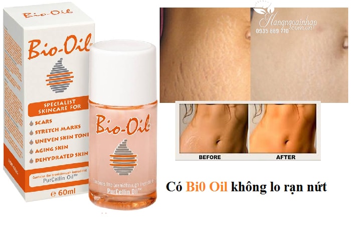 Tinh dầu Bio-Oil 60ml của Úc - Kem chống trị rạn da, làm mờ sẹo (2)