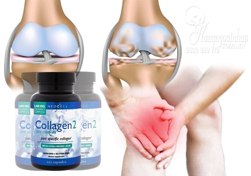 Collagen Type 2 - Collagen Tuýp 2 Không Biến Tính Của Mỹ