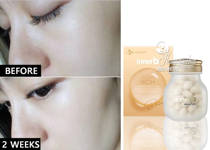 Viên uống cấp nước và Collagen Innerb Aqua Rich chính hãng 3
