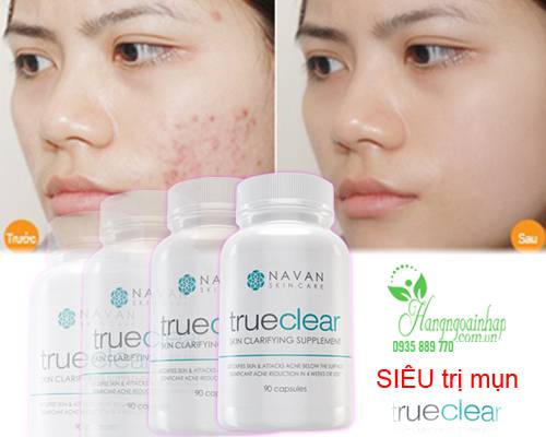 Viên uống trị mụn Navan TrueClear Skin Clarifying Supplement 90 viên của Mỹ