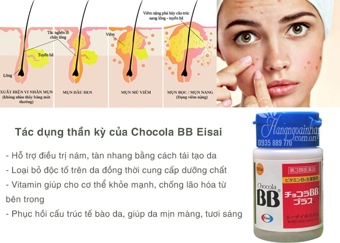 Viên uống trị mụn, nám, tàn nhang Chocola BB Eisai 180 viên chính hãng Nhật Bản 