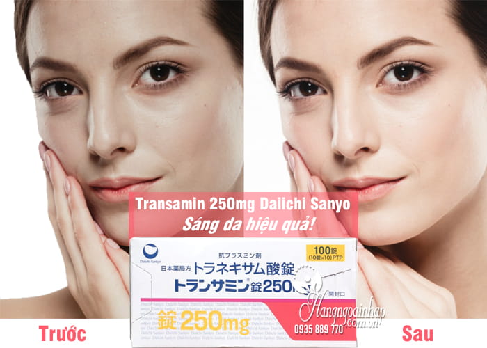 Viên uống sáng da trị nám Transamin 250mg Daiichi Sanyo của Nhật 1