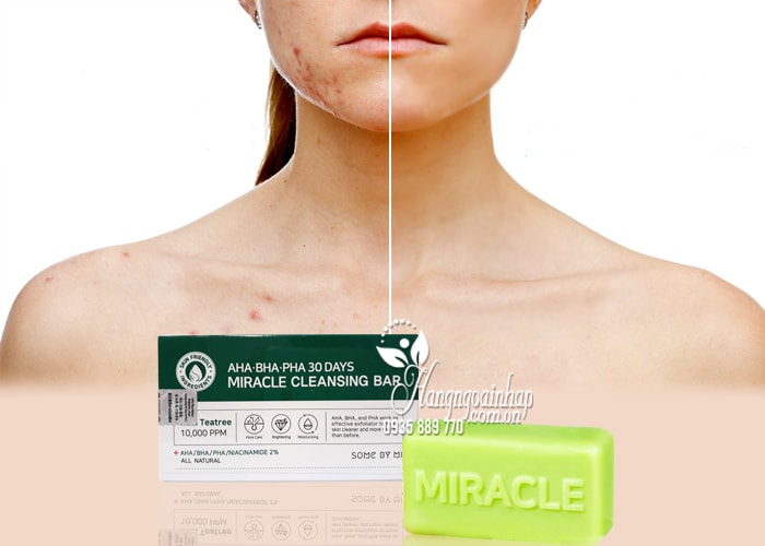 Xà phòng trị mụn Miracle AHA BHA PHA 30 Days Bar Hàn Quốc 4